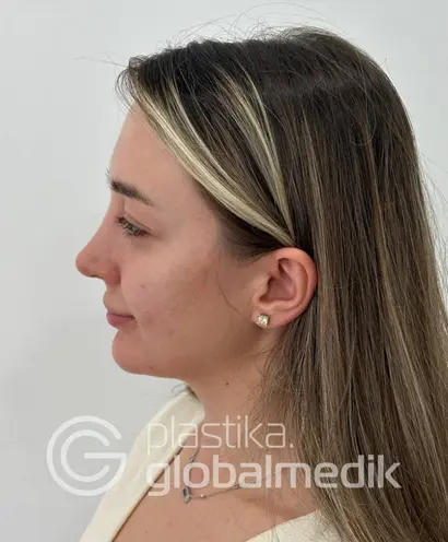 Фото после №7